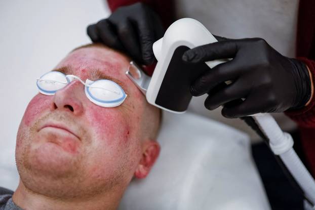 Former Ukrainian serviceman, who was wounded at a front line, comes to a clinic to treat scars, in Kyiv