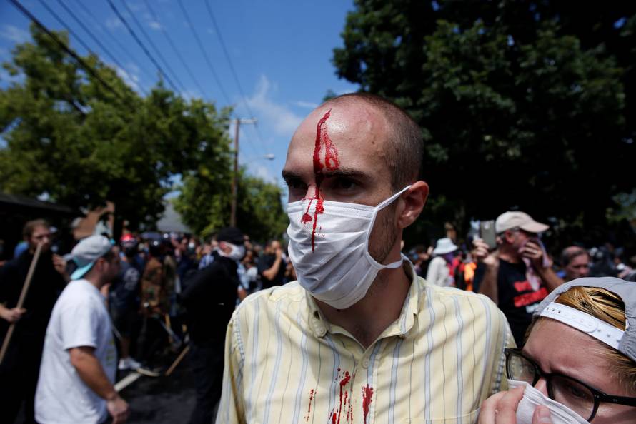 A man is seen with an injury during a clash between members of white nationalist protesters against a group of counter-protesters in Charlottesville