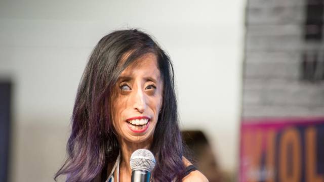 Anaheim, CA Â June 23: Motivational speaker Lizzie VelÃ¡squez speaks at VidCon 2015 at the Anaheim Convention Center in Anaheim,