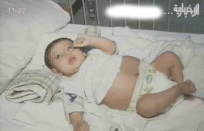 Liječnici otkrili da je beba koja se rodila prije 30 dana 'trudna'