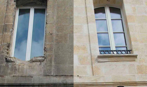 Lasersko &ccaron;i&scaron;&cacute;enje u restauraciji: Sigurno skidanje naslaga