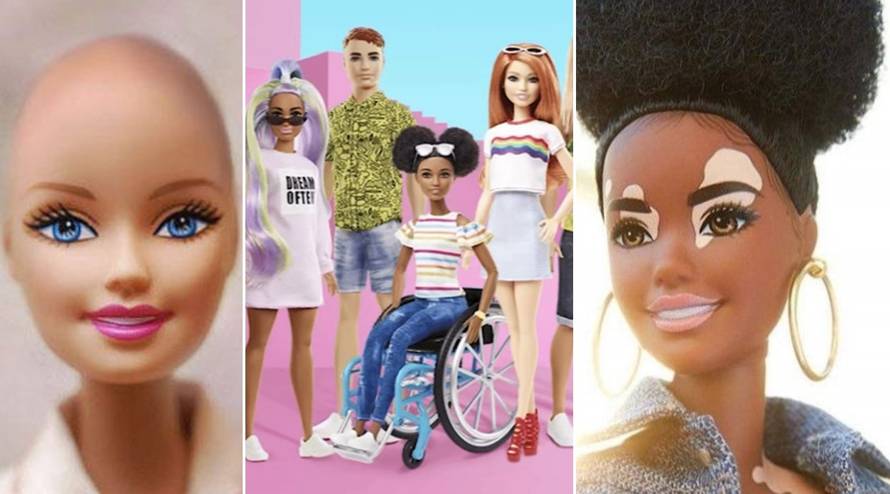 Omiljena lutkica: Barbie odsad dolazi s vitiligom i bez kose
