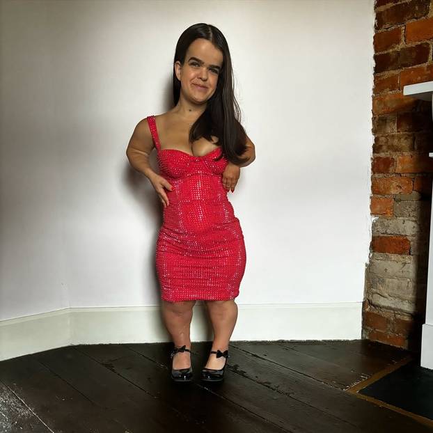 FOTO Visoka sam 112 cm i model sam! Ljudi govore nepristojne komentare kad vide mog dečka