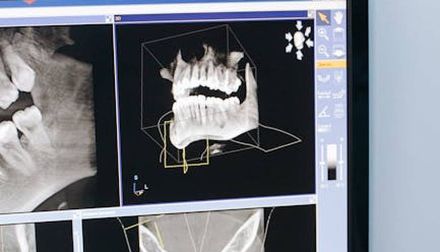 Nova generacija stomatološkog liječenja za zdrav osmijeh