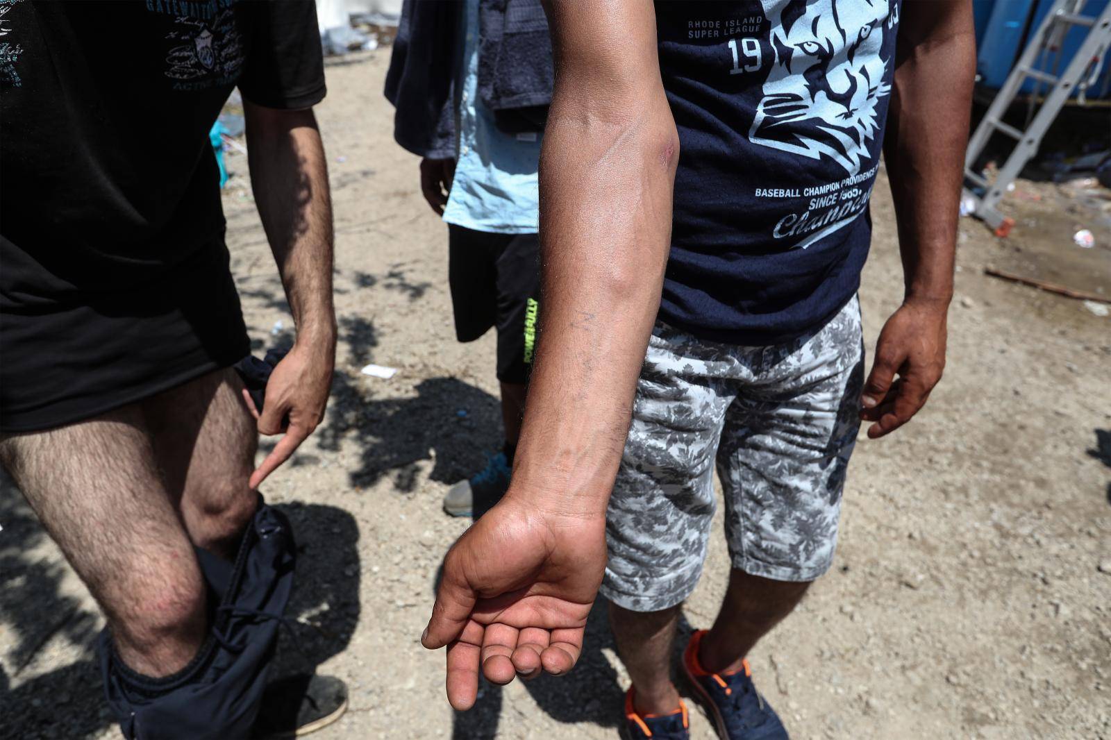 U tučnjavi kod Bihaća četiri su migranta lakše ozlijeđena