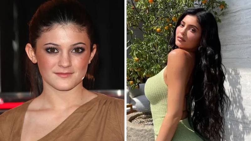 Sve operacije Kylie Jenner: Od iznosa će vas zaboljeti glava