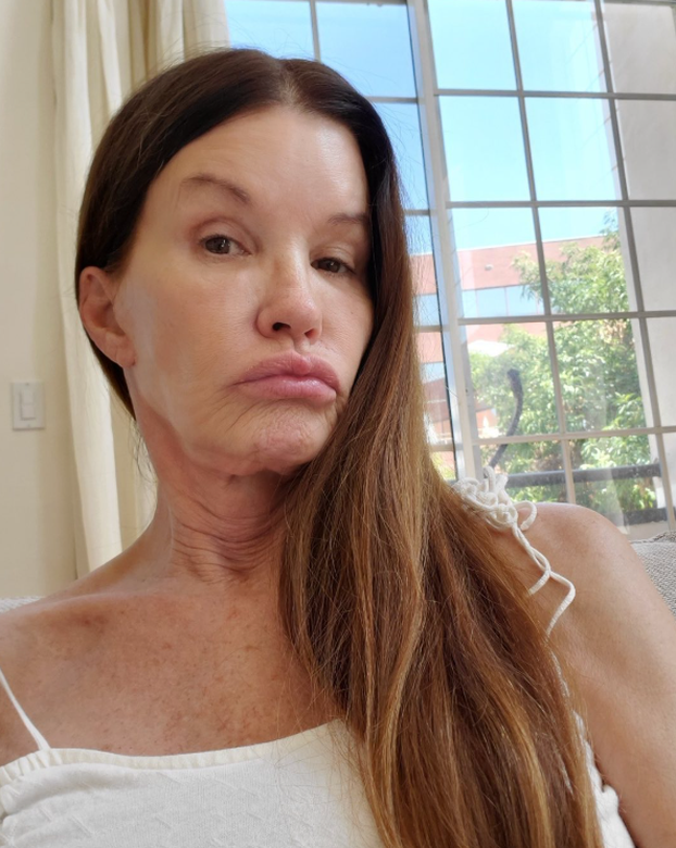 FOTO Bila je jedna od najljepših manekenki, a onda je pala u dugove zbog plastičnih zahvata