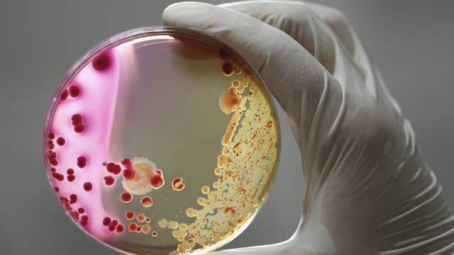 Antimikrobni lijekovi: Sve više superbakterija otporno na njih