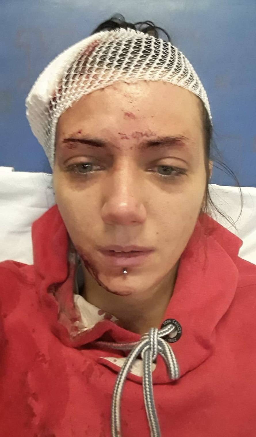 'Napao me sjekirom, a pustili su ga da se brani sa slobode'