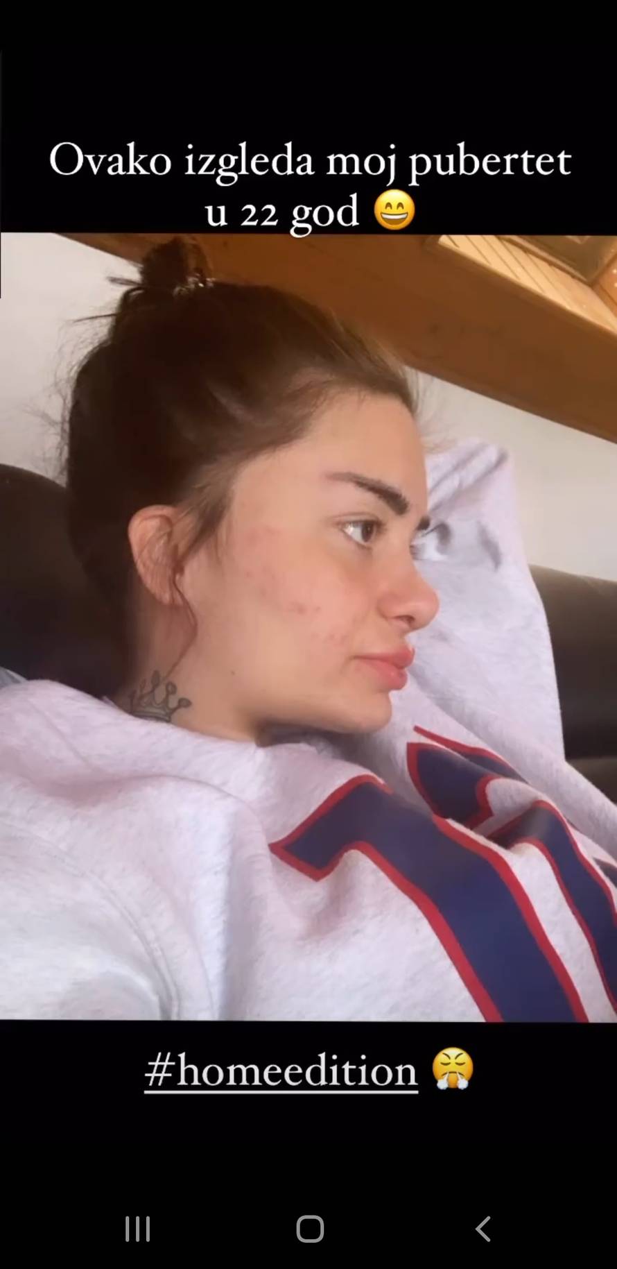 Mandarina priznala: Imam akne i bubuljice, skrivam ih puderom