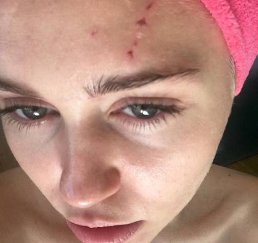 'Sje***a me mačkica': Miley je imala krvavi 'okršaj' s mačkom