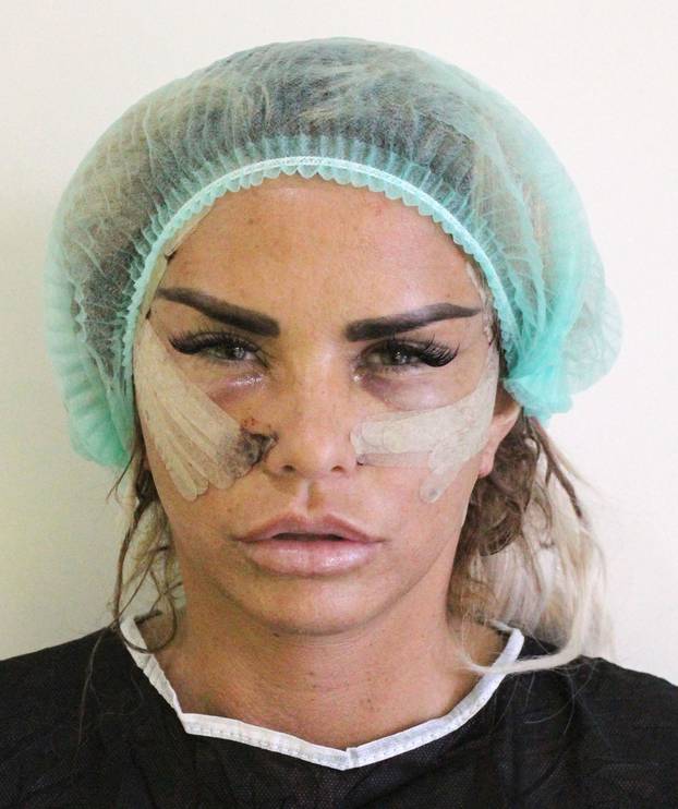 *PREMIUM-EXCLUSIVE* Former Glamour Model Katie Price Aka Jordan goes under the knife as she