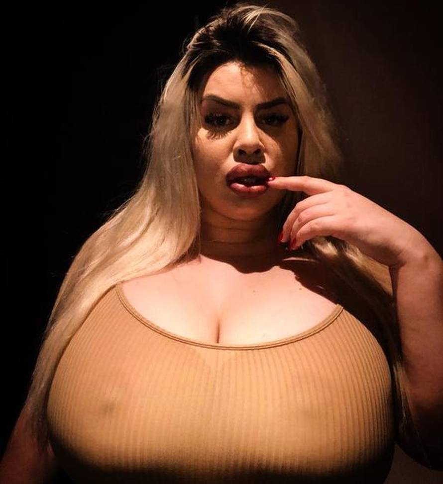 Srpkinja pretjeruje: Doktore, daj mi premjesti bradavice niže