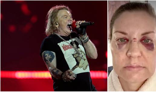 Axl Rose mikrofonom pogodio obožavateljicu: Prvo se ispričao pa obećao da se neće ponoviti