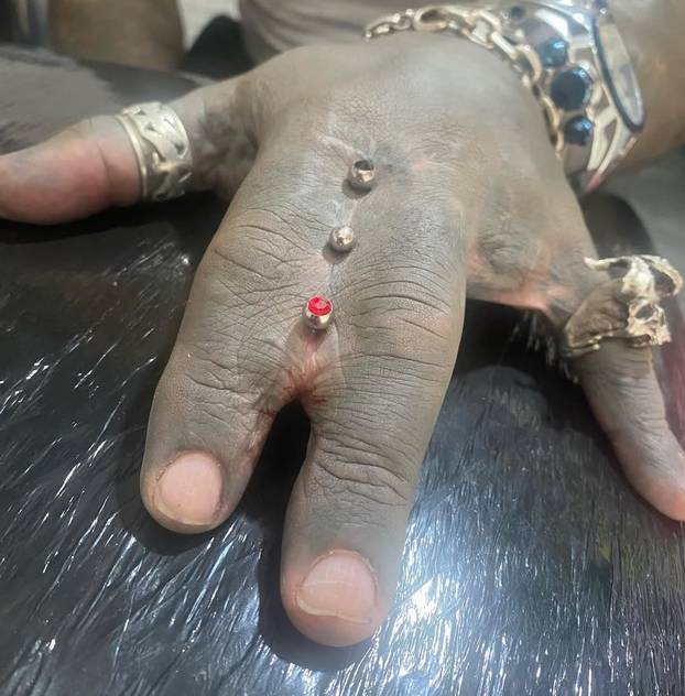 FOTO Uznemirujuće! Uklonila je čak i vrh nosa, a evo kako je izgledala: Šteta, ljepotica si bila