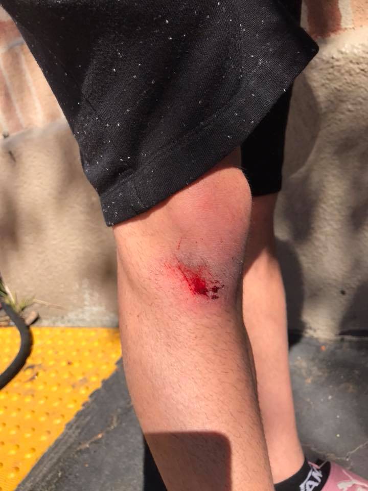 Ashton Kutcher autom udario tinejdžera i srušio ga na zemlju