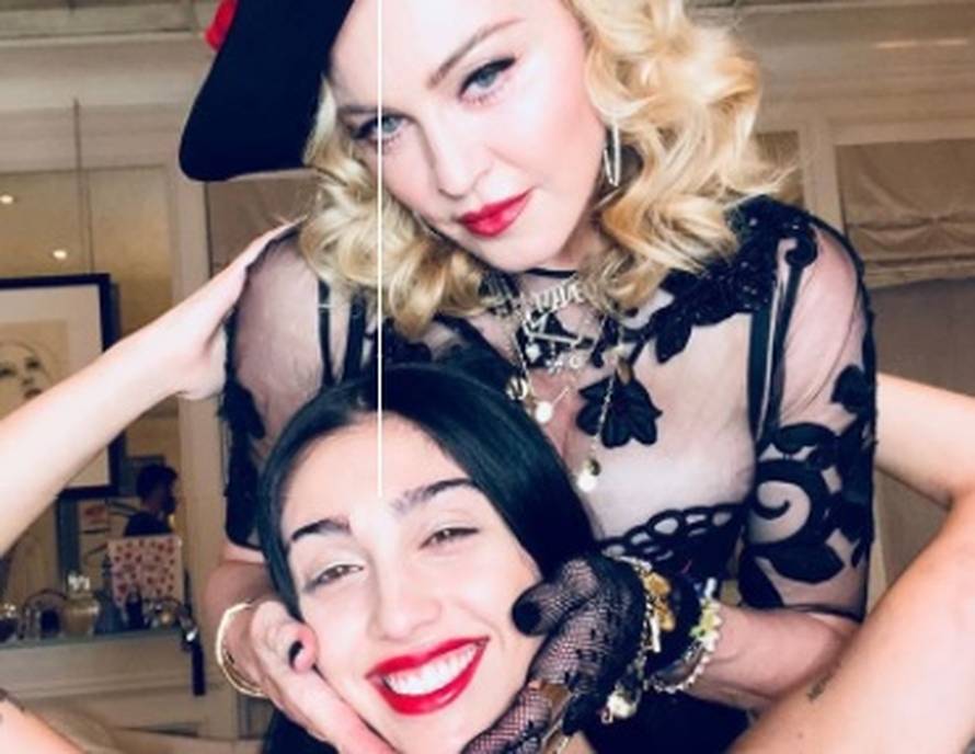 Nakon tretmana lica vilicama, Madonna je pozirala u toplesu