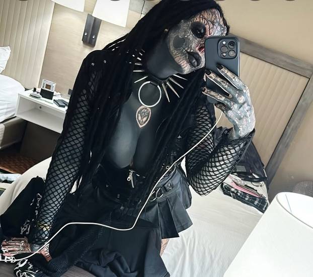 FOTO Uznemirujuće! Uklonila je čak i vrh nosa, a evo kako je izgledala: Šteta, ljepotica si bila