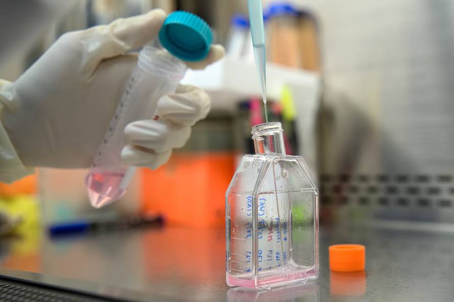 Rano otkrivanje raka pluća CT-om značajno smanjio smrtnost