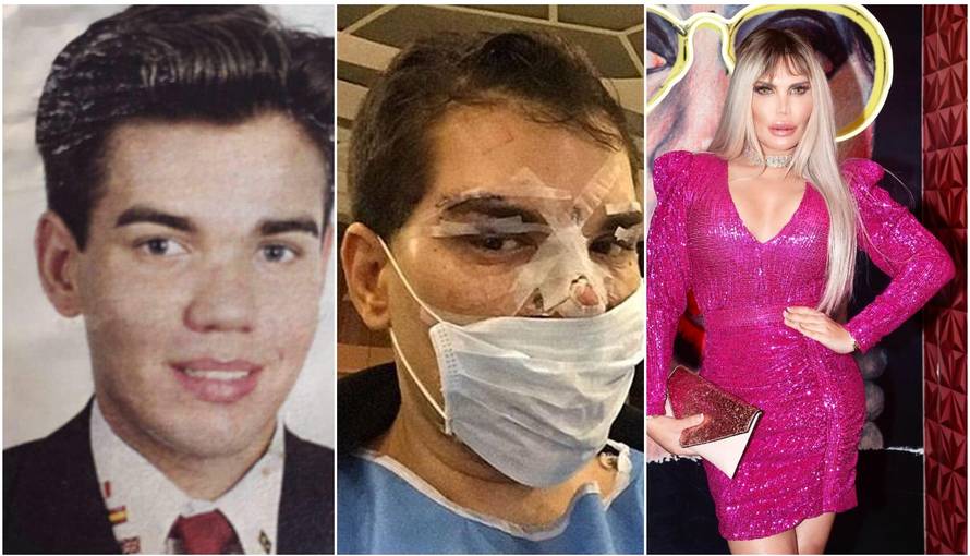 Bio je Ken pa Barbie: Ovisnik o nožu pokazao kako je izgledao