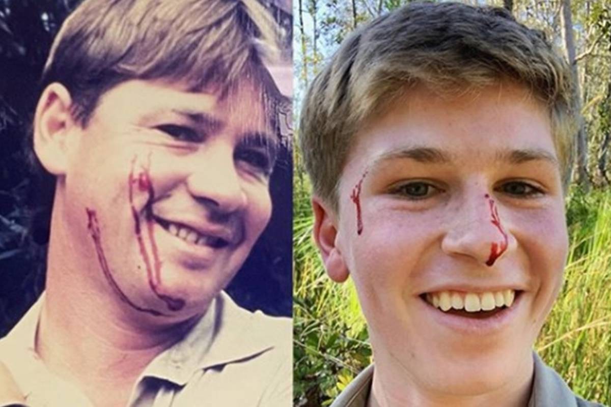 Sina (16) pokojnog lovca na krokodile ugrizla zmija: 'Isti ste'