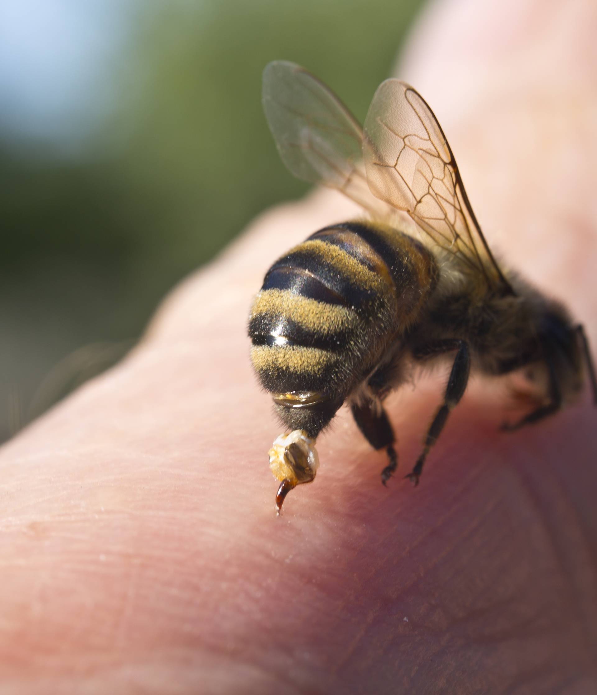Jeste li alergični na ose i pčele možete saznati i prije uboda