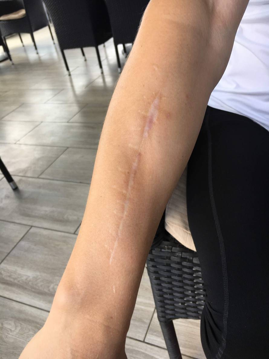 Rastura prepone i - marketing: Šarafe u ruci nosit ću do smrti