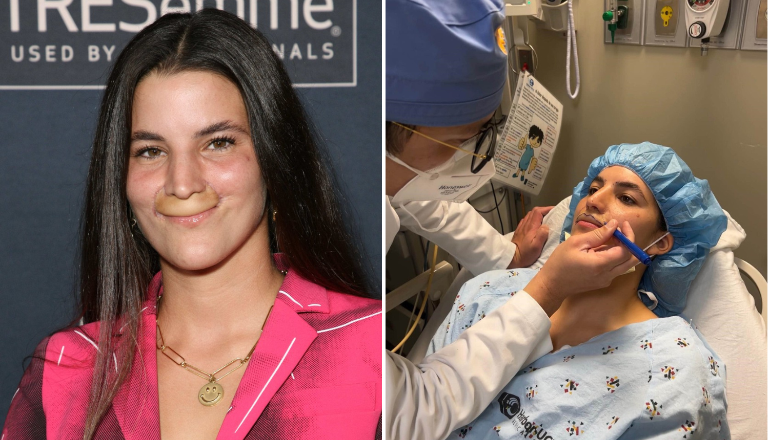 Pit bull joj je odgrizao usnu, a nakon 7 operacija manekenka ponosno pokazala novi osmijeh