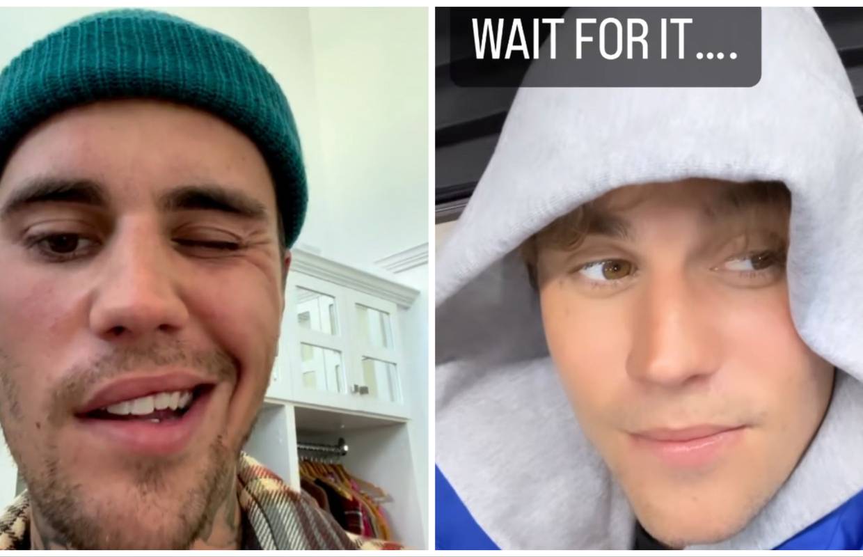 Justin Bieber snimio video kako pomiče lice zbog teške borbe sa sindromom: 'Ide mu sve bolje...'