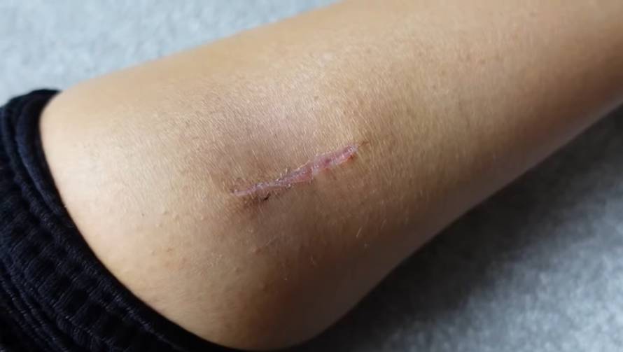 Influencerica u suzama: 'Hodala sam s rakom na nozi, ljuta sam'