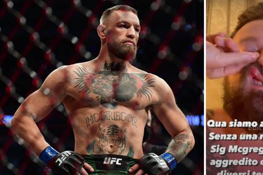 McGregor pretukao poznatog DJ-a: 'Razbio mi je nos i usta, pogledajte! Tužit ću nasilnika'