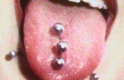 Od piercinga možete imati stomatološke komplikacije
