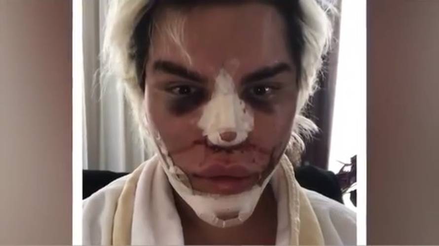 Ljudski Ken želi mačkaste oči: 'Dosta mi je dosadnog izgleda'