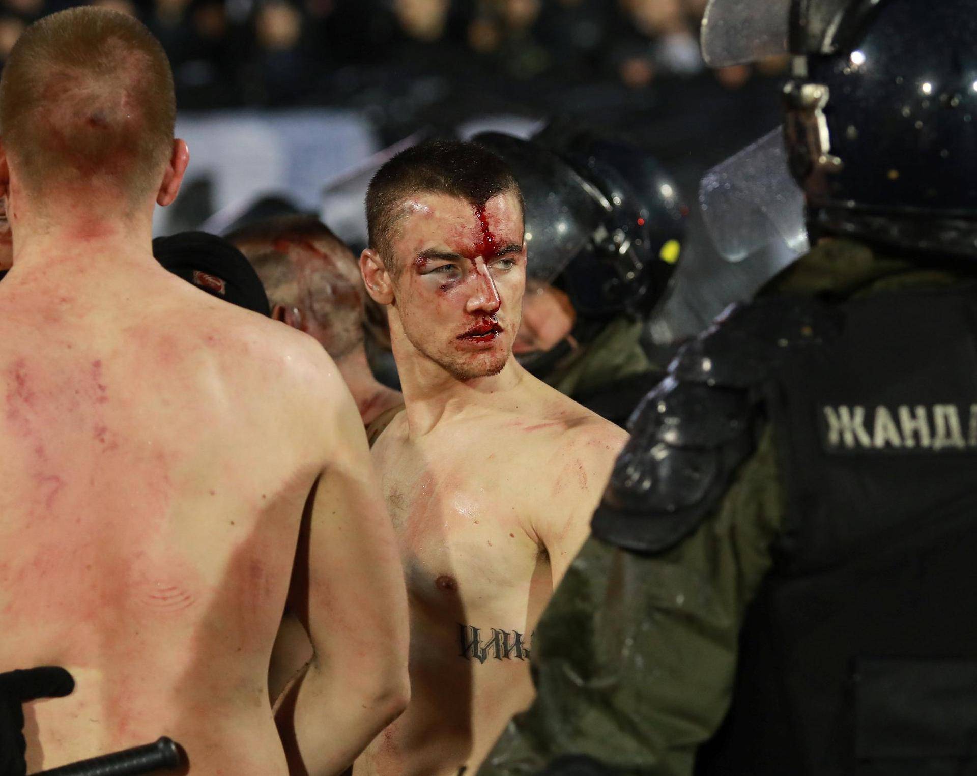 Police escort the soccer fans injured during the fights at a match between Red Star and Partizan in Belgrade