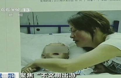 Majka mijenjala pelene sinu, majmun bebi otkinuo testis