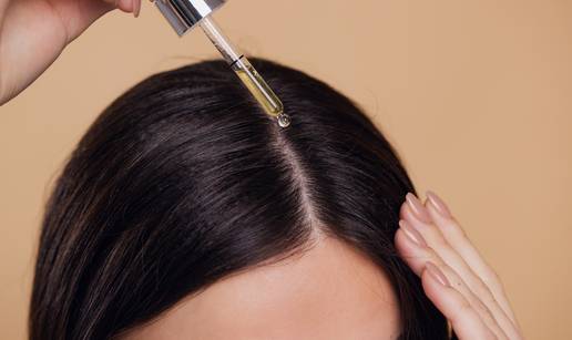 Opada vam kosa, brzo se masti ili imate prhut? Evo &scaron;to stvarno poma&zcaron;e!