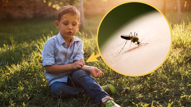 Trikovi kako zaustaviti svrab nakon što vas ubode komarac