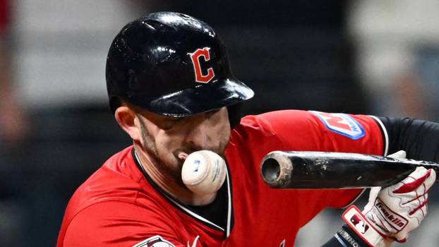 Ovako izgleda lice čovjeka kad ga pogodi loptica sa 160 km/h