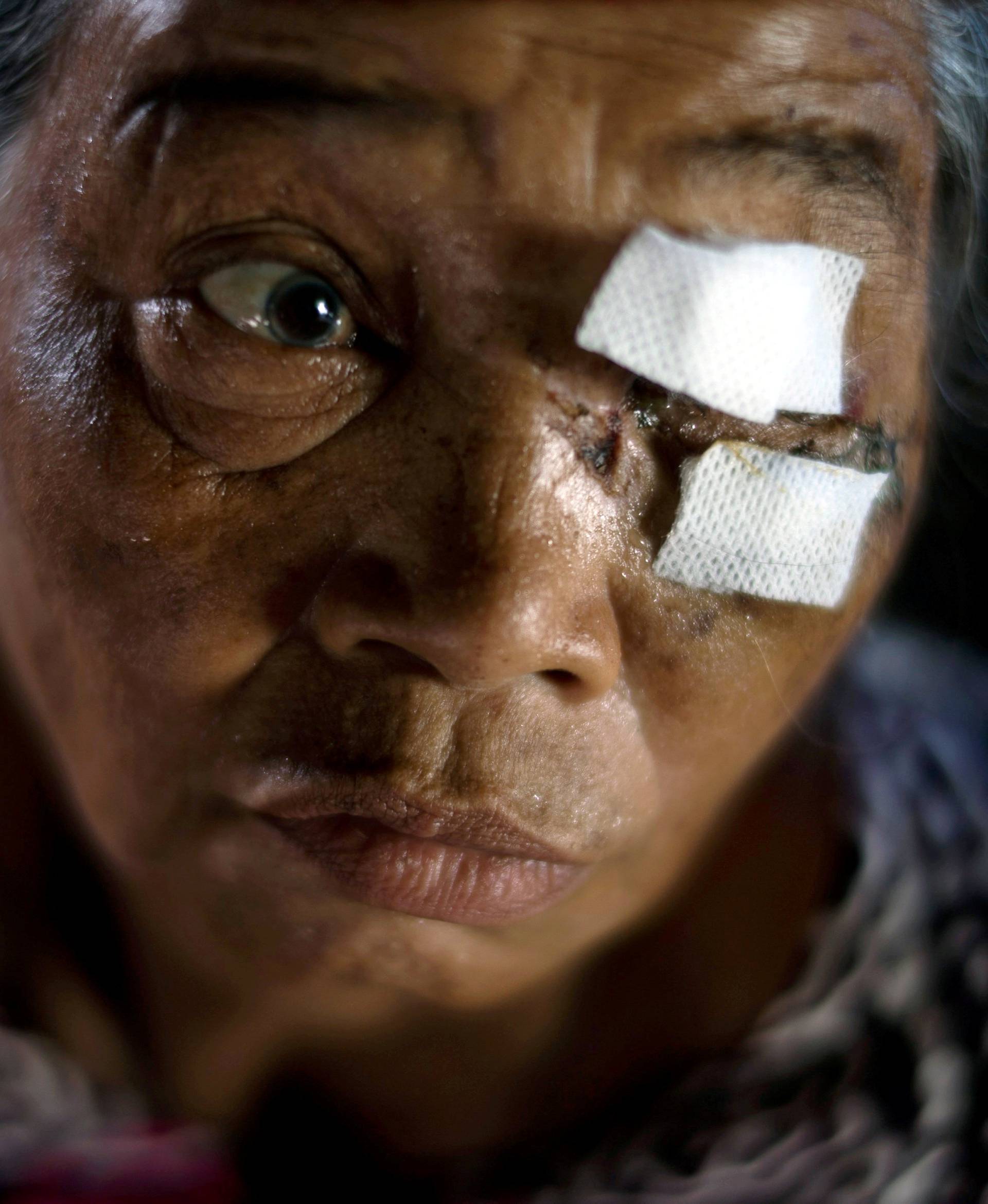 A villager affected by an earthquake and tsunami is pictured at a hospital in Palu