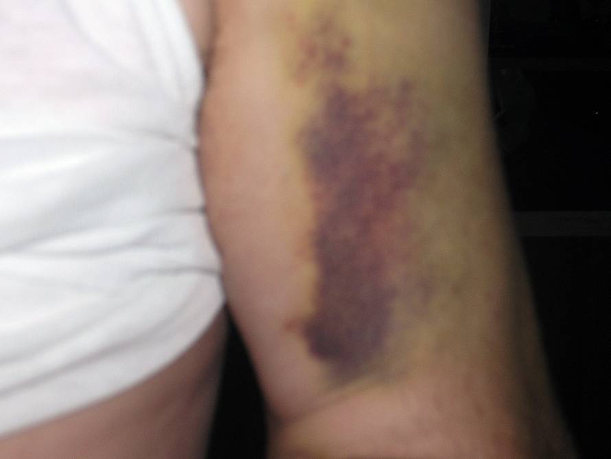 Željko Hladika/24sata