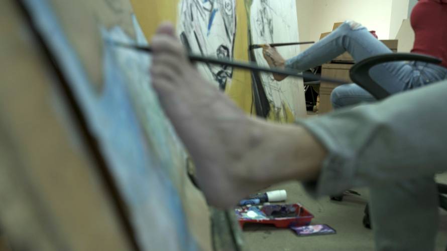 Dejana nema obje ruke, a Suljo jednu: 'Mi se grlimo pogledima'