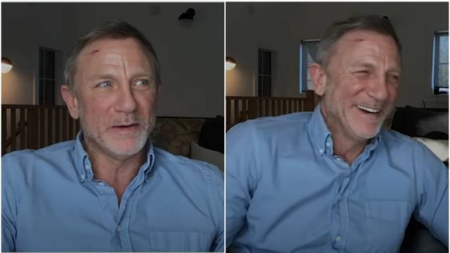 VIDEO James Bond je odradio intervju dok je krvario iz glave