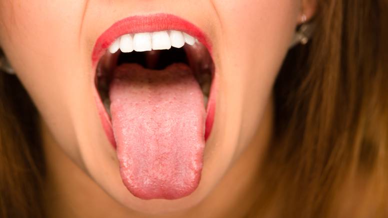 8 načina na koje vam vaš jezik 'govori' kakvo vam je zdravlje