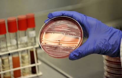 Prva zaraza super bakterijom otpornom na sve antibiotike