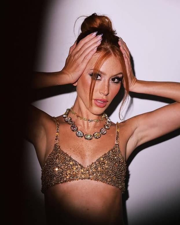 FOTO Posebna ljepota: Milijuni ljudi obožavaju njezine pjegice