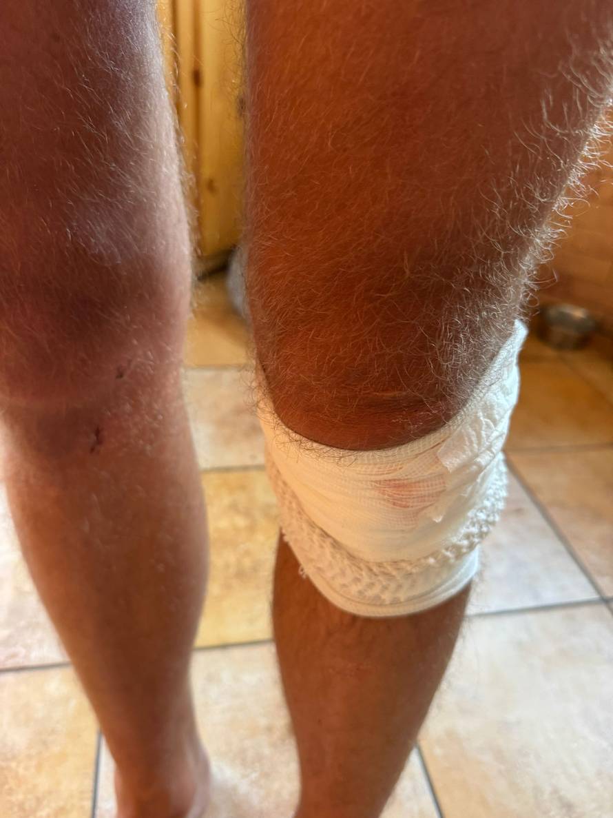 Stručnjaci o slučaju Slovenaca koje su tukli i palicom: 'Skandal je to što zaštitare nisu priveli'