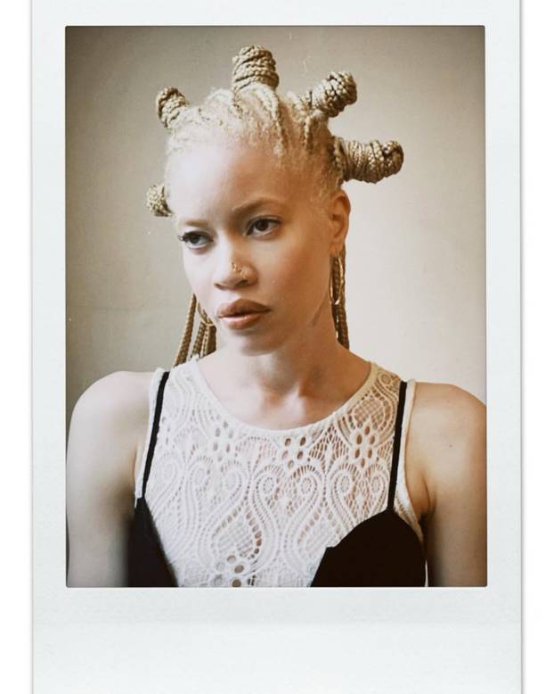 FOTO Afrikanka s albinizmom osvaja modnu industriju: 'Često privlačim znatiželjne poglede'