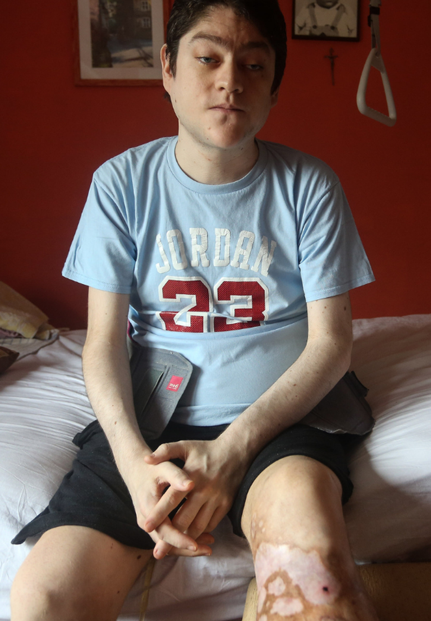 Korak do doktorata: Operacija bi me mogla dići natrag na noge