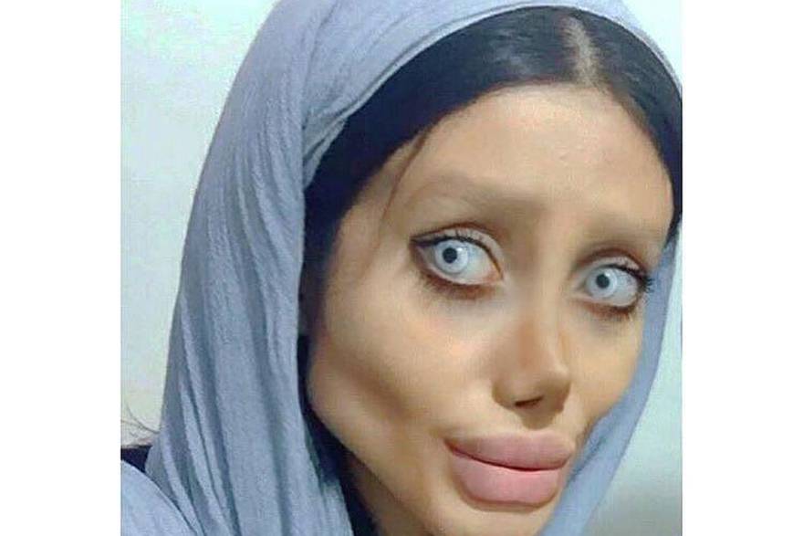 Iranska Angelina ima korona virus