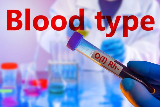 Determination of blood type. A test tube with the first group of blood with a negative rhesus. RH factor. Medical test. Research of biological fluids. Laboratory blood tests.